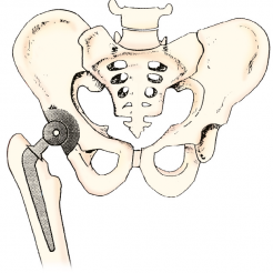 Kinesiology of the Hip: A Focus on Muscular Actions